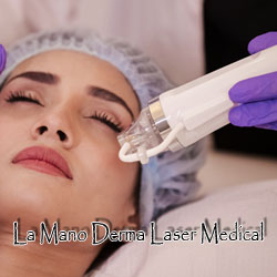 La Mano Derma Laser Medical